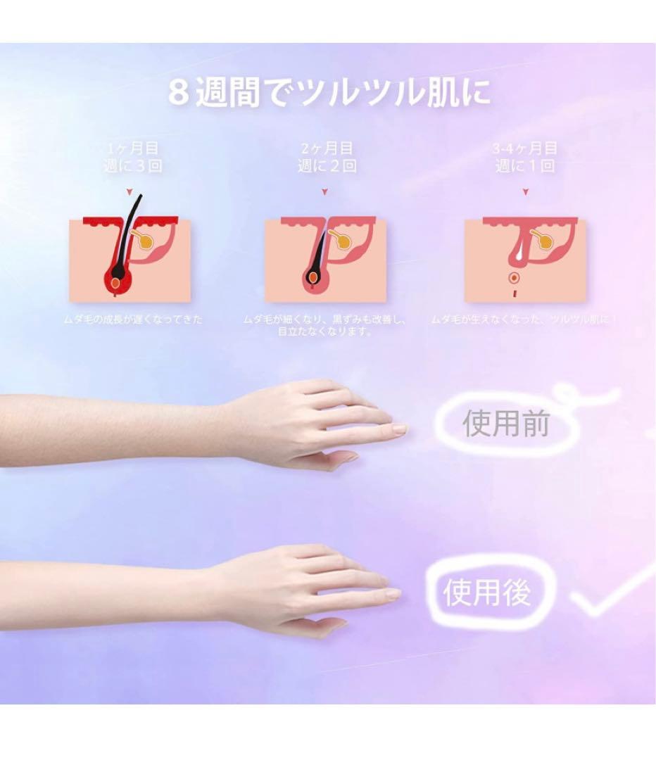 ⭐️脱毛器 サファイア冷感脱毛機 全身脱毛 IPL光脱毛器 vio対応⭐️