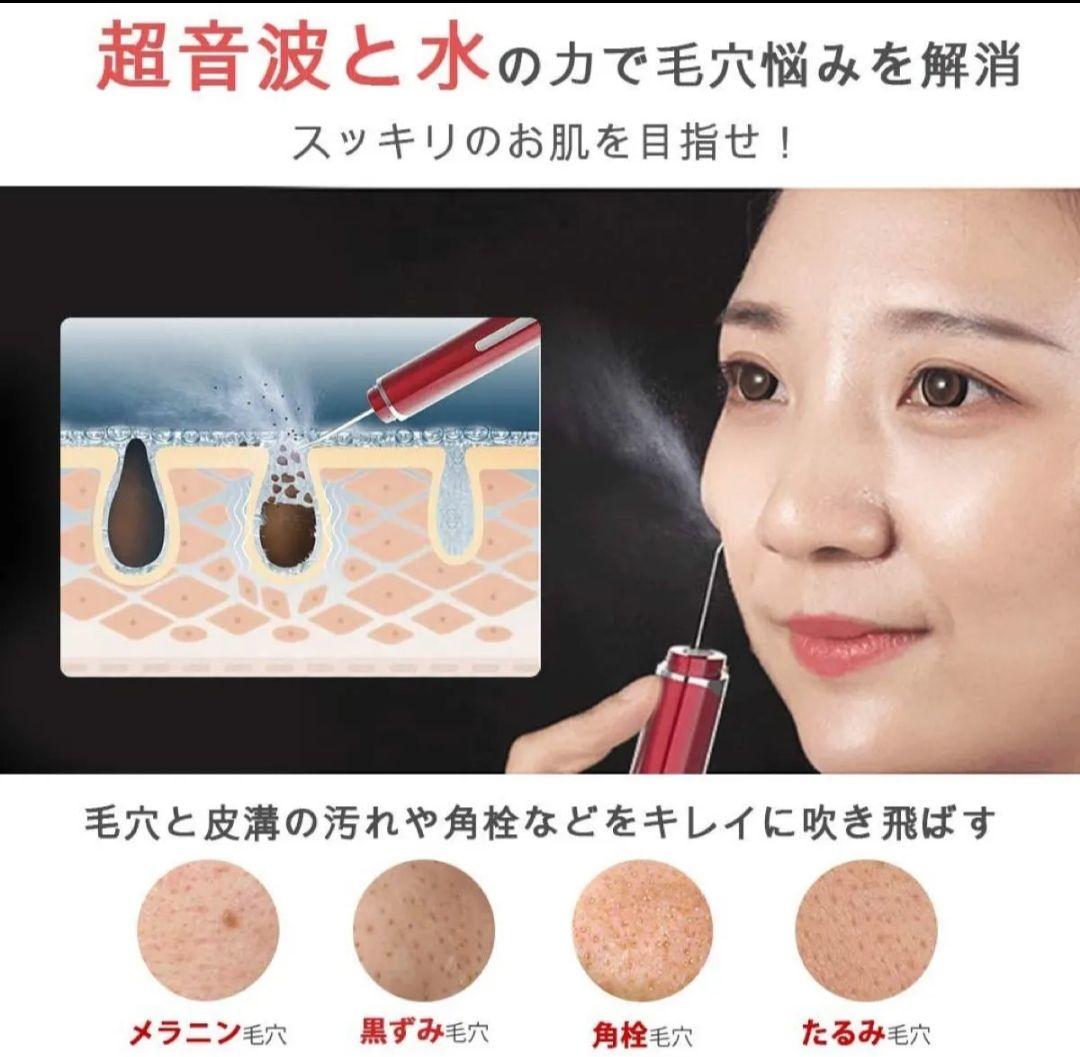 ANLAN 美顔器