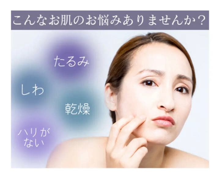 モテリフト 美顔器