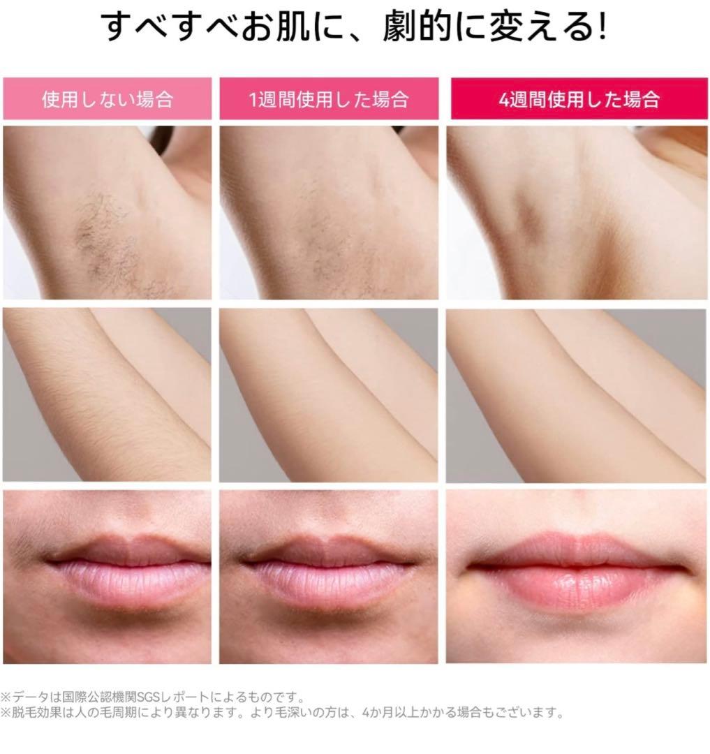 [新品!!!] Ulike Air Pro IPL光美容器 脱毛器