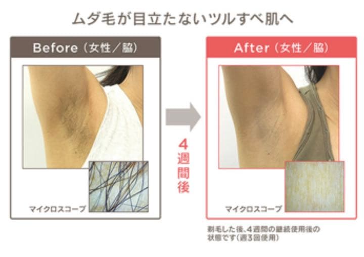 ★ムダ毛ケア フラッシュ式【MEスマートエピレーションプレミアム】光美容器未使用