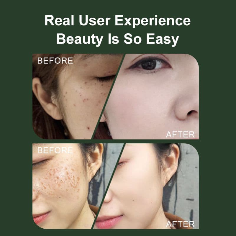 ✨️VLVEE 16 顔シミ取り美顔器✨️