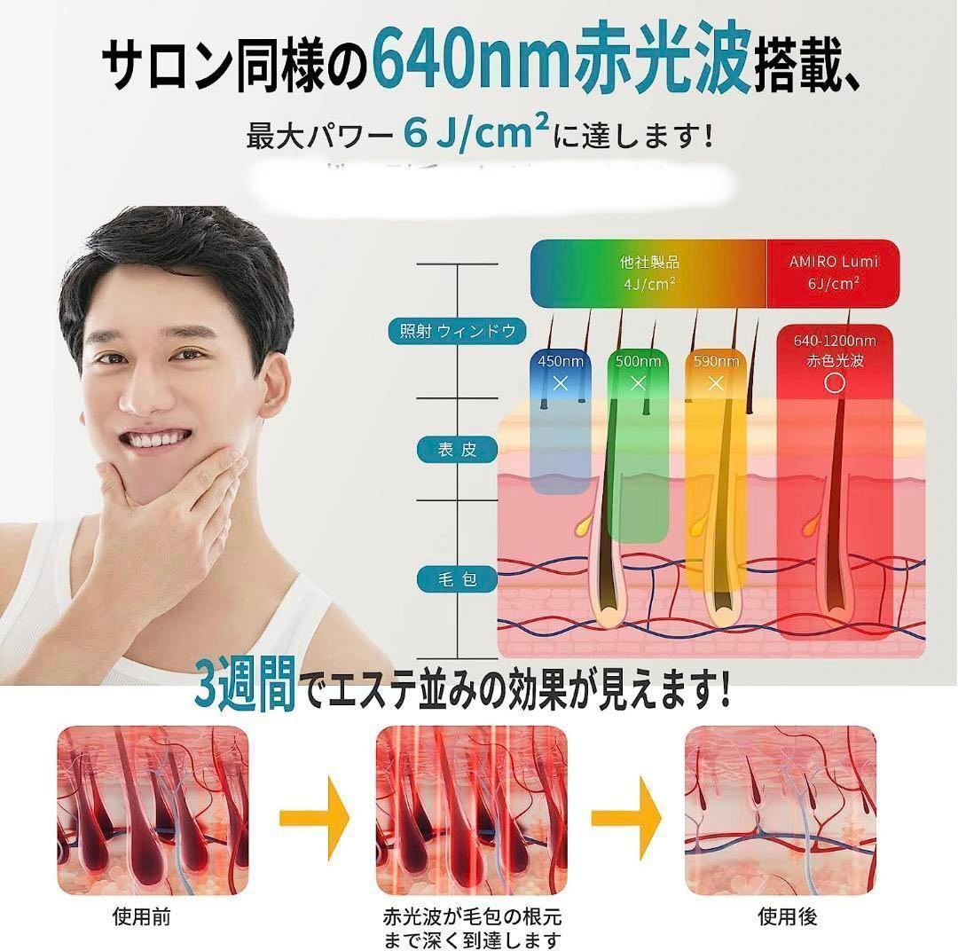 光美容器 脱毛器 メンズ　レディース　最高峰パワー6J/cm² 赤光波搭載