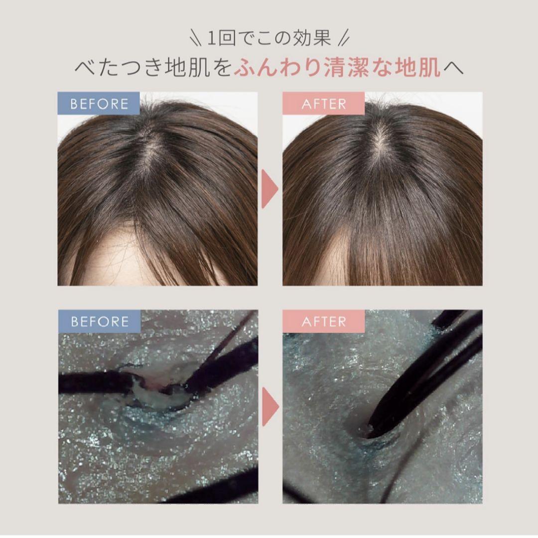 【新品未開封】ヤーマン ミーゼ ニードルヘッドスパリフト MS-31N