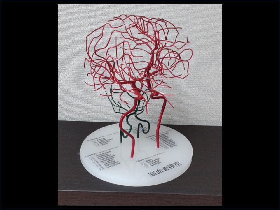 脳血管模型（内頚動脈、椎骨動脈）