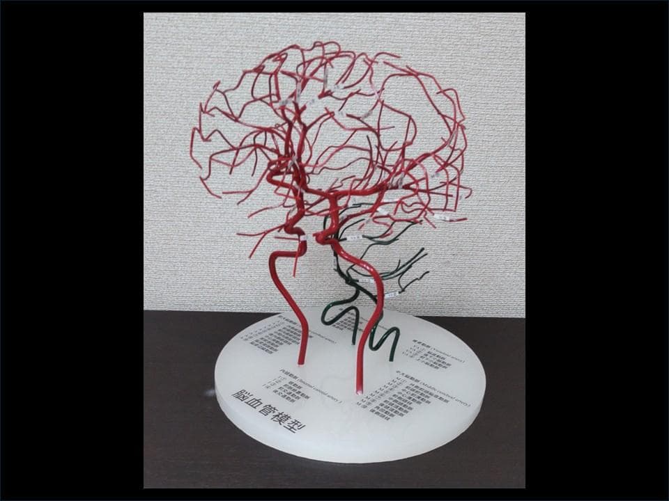 脳血管模型（内頚動脈、椎骨動脈）