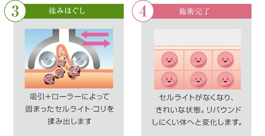 SFOCRABさま専用【新型】【正規品】Hyper Shape（ハイパーシェイプ