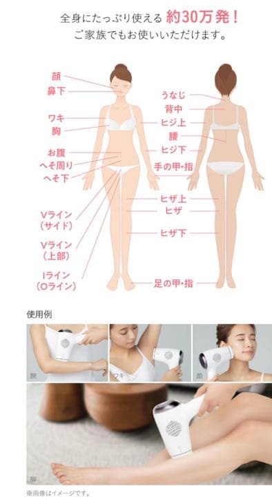 ミュゼ脱毛器