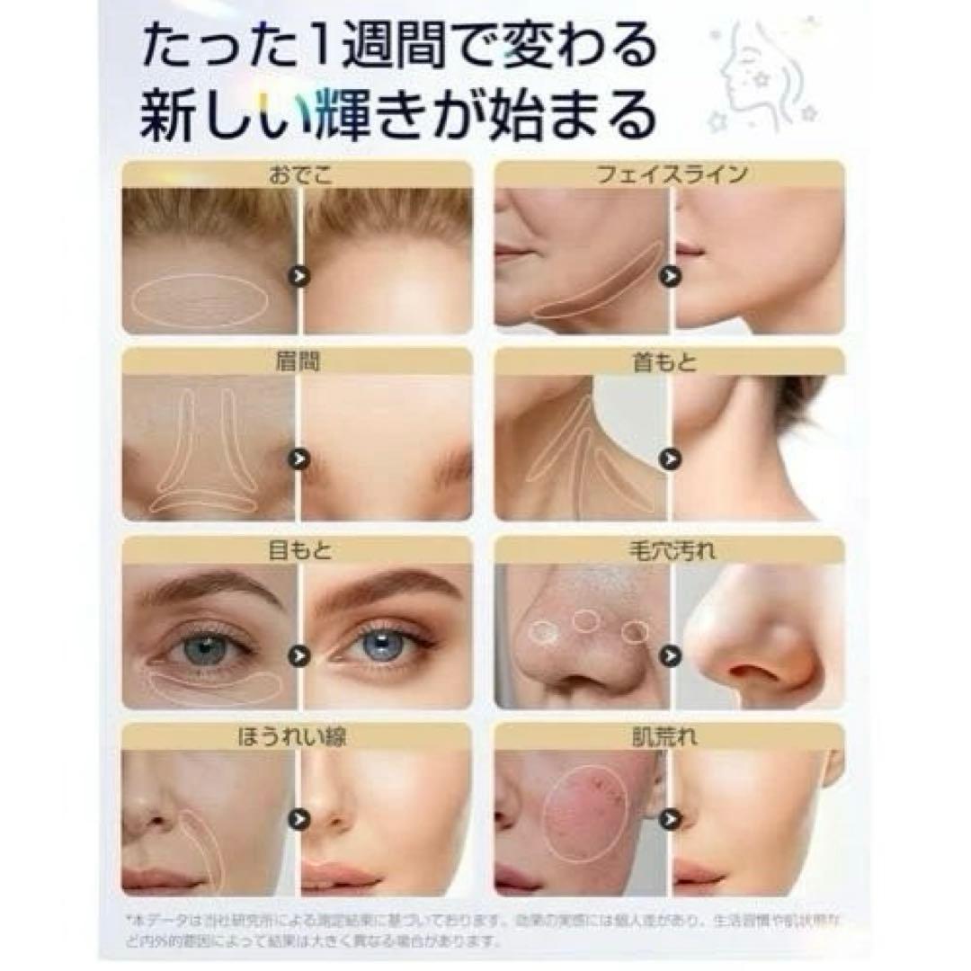 美顔器 高周波 RF EMS MC 1台18役 温冷 リフトケア　毛穴洗浄