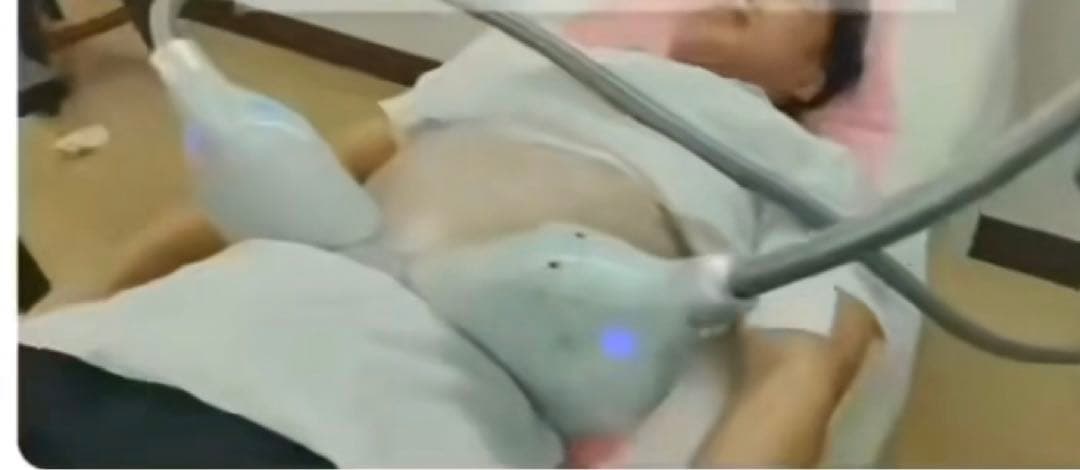 大人気電磁パルスと脂肪冷却が1台にセット！