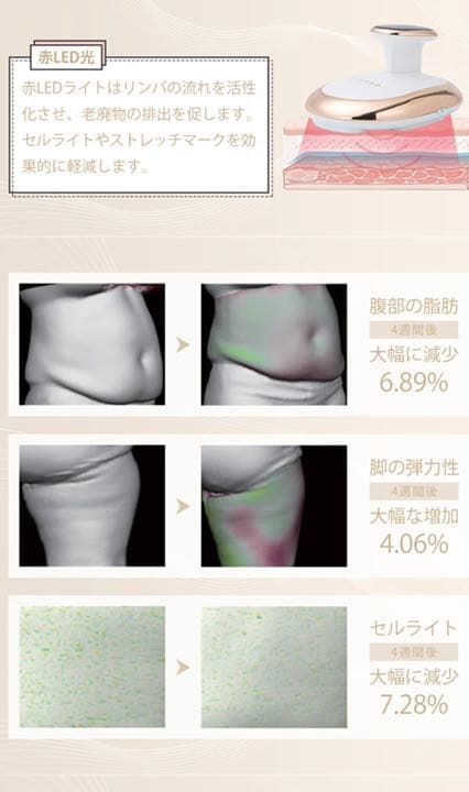 FITPADキャビテーション