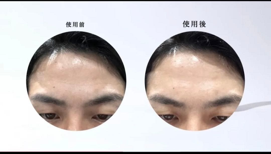 レレレさんおすすめ美顔器INGRACE Pullquart プルクウォート