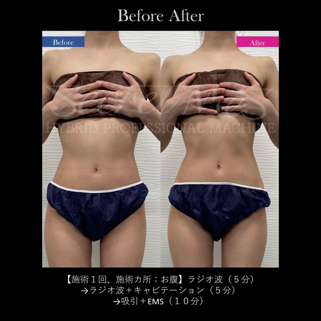 《美品》Secretmes 【シークレットメス】/限定2台/定価260万円