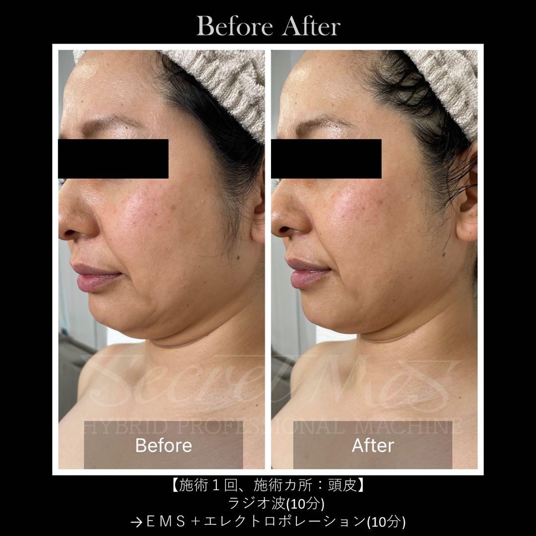 《美品》Secretmes 【シークレットメス】/限定2台/定価260万円