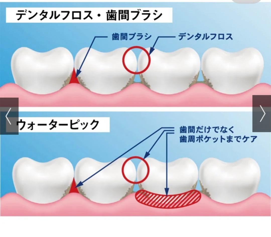 ディノス購入/Waterpik*ウォーターフロッサー/ヤーマン